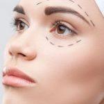 Блефаропластика – какие особенности и на что обратить внимание